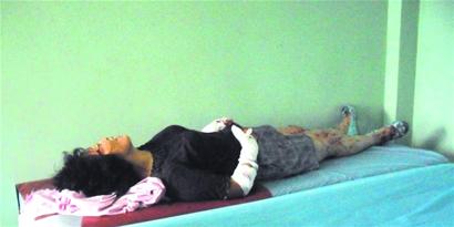 天气炎热宠物狗发狂 居然把主人咬成重伤(图)