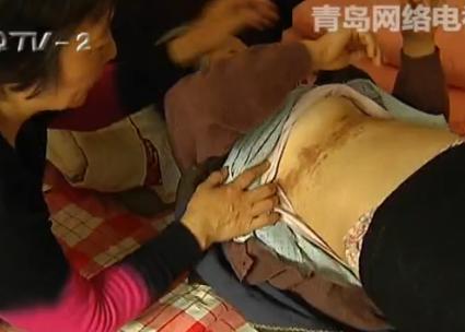 寻医问药：带状疱疹知多少