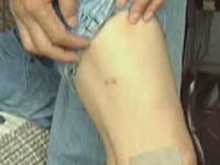 主播关注：狗粉凶猛打伤反狗医生