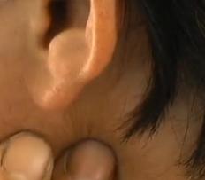 寻医问药：耳根账疼怎么回事？