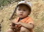 浑身长毛的异类孩子