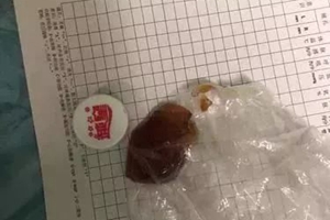 心痛！又是这种常见零食！5岁女孩吃了后不幸离世……