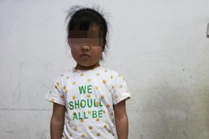 女孩鼻窦炎反复，医生发现竟是因为骨头变“石头”，父母为表兄妹