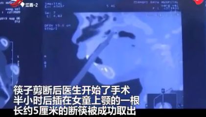 筷子从女孩口腔插进鼻腔!画面里一幕,令人揪心!