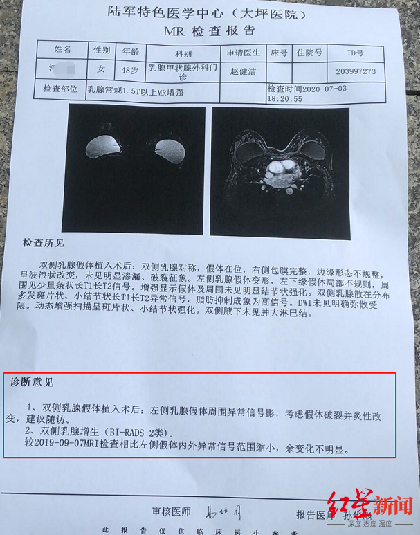 隆胸|做隆胸的医生竟是口腔专业？女子术后疑似假体破裂