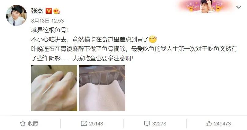 鱼刺|鱼刺卡在食道，赶紧喝醋、吃馒头？都错了！