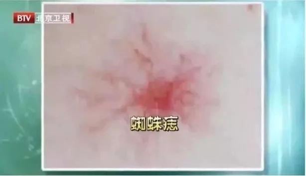 各种疾病的早期信号，都在这里了！知道了省钱又救命，赶紧学起来！