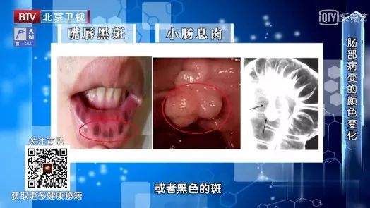 各种疾病的早期信号，都在这里了！知道了省钱又救命，赶紧学起来！