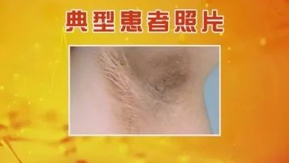 各种疾病的早期信号，都在这里了！知道了省钱又救命，赶紧学起来！