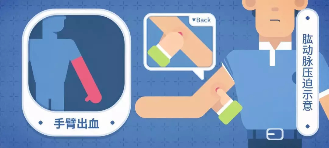 突发事故受伤出血教您几招现场急救快速止血方法